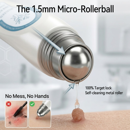 𝐇e𝐚𝐥𝐫i𝐳e® 7-𝐷𝑎𝑦 𝗧𝐚𝐠 & 𝗦𝗽𝐨𝐭 𝐄𝐫𝒂𝒔𝒆𝒓(Zero Pain, Zero 𝐒𝐜𝐚𝒓𝒔 Rollerball) 💝