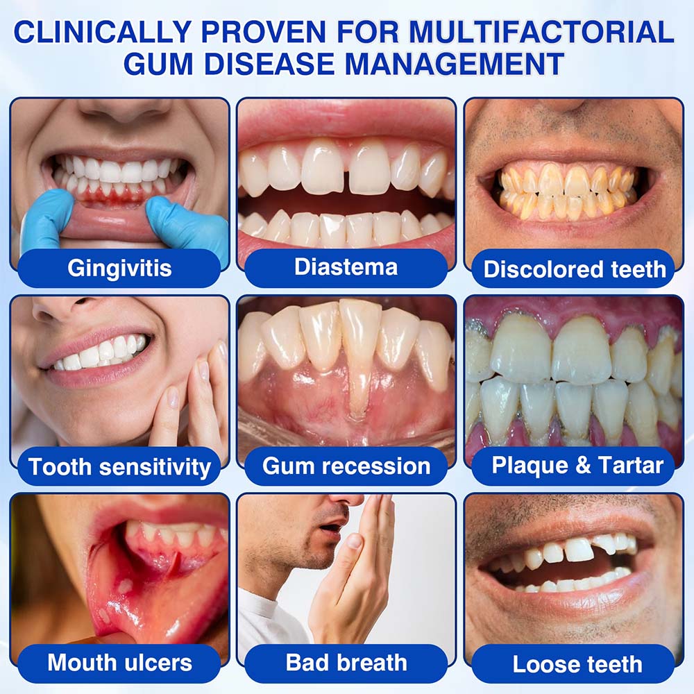 🦷 Healrize® GumRevive Periodontal Repair Gel (for bleeding gums, receding gums, and loose teeth)🐳