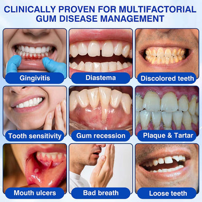 🦷 Healrize® GumRevive Periodontal Repair Gel (for bleeding gums, receding gums, and loose teeth)🐳