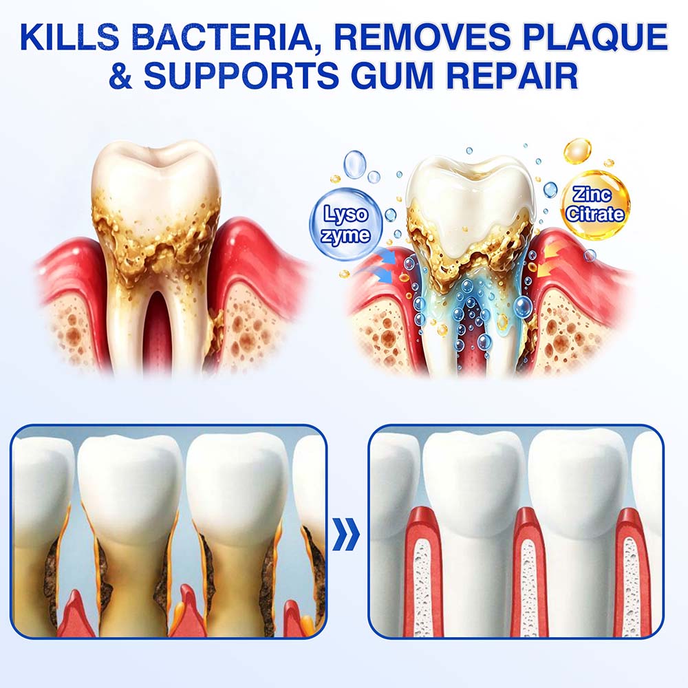 🦷 Healrize® GumRevive Periodontal Repair Gel (for bleeding gums, receding gums, and loose teeth)🐳