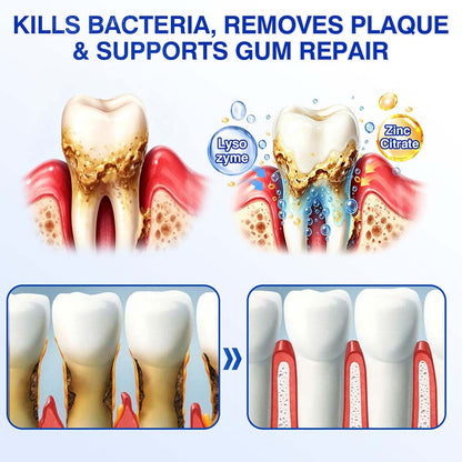 🦷 Healrize® GumRevive Periodontal Repair Gel (for bleeding gums, receding gums, and loose teeth)🐳