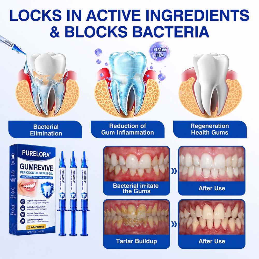 🦷 Healrize® GumRevive Periodontal Repair Gel (for bleeding gums, receding gums, and loose teeth)🐳