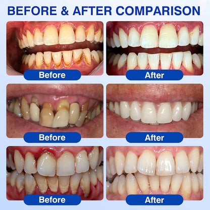 🦷 Healrize® GumRevive Periodontal Repair Gel (for bleeding gums, receding gums, and loose teeth)🐳